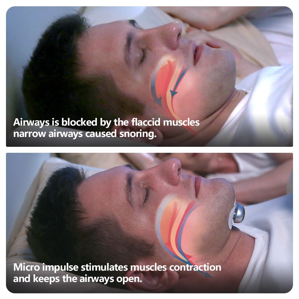 Smart Anti-Snoring Device & Muscle Stimulator Pro | Tillmart